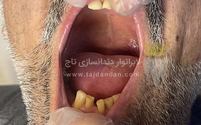ویزیت بیمار توسط مطب دندانسازی تاج 