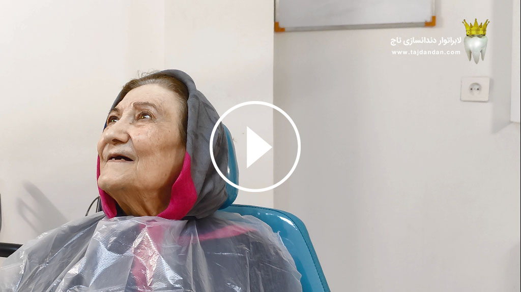 رضایت بیمار 82 ساله اهل مهر شهر کرج از ساخت پروتز دندان ایووبیس سوئیسی