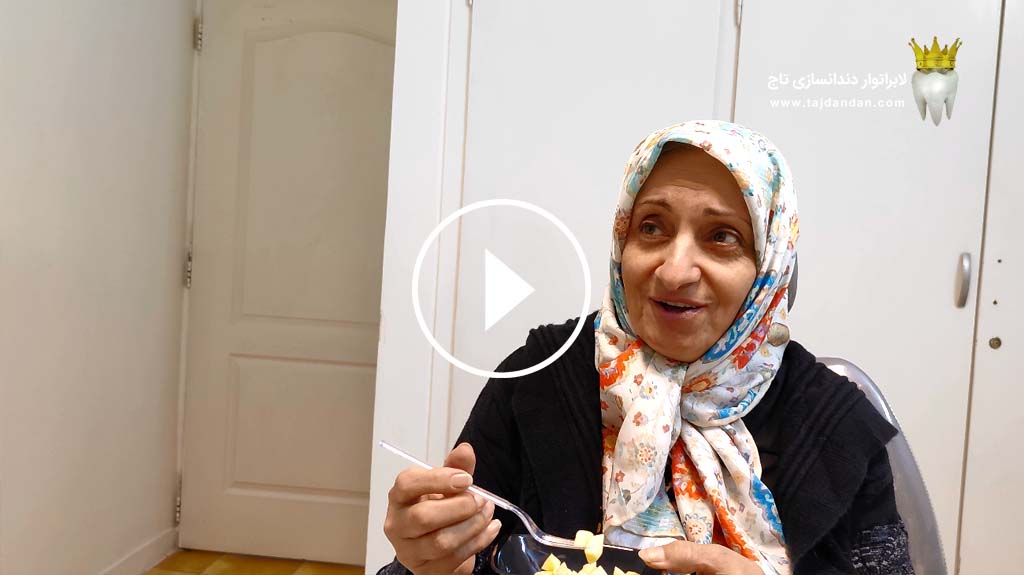 رضایت بیمار 67 ساله تهرانی فاقد لثه از ساخت پروتز دندان متحرک ایووبیس سوئیسی