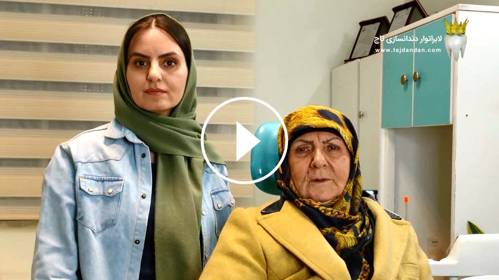 رضایت بیمار 68 ساله اهل تبریز با تحلیل لثه شدید از ساخت پروتز دندان متحرک